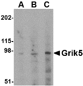 GRIK5 / KA2 Antibody - Western blot of Grik5 in human brain tissue lysate with Grik5 antibody at (A) 0.5, (B) 1 and (C) 2 ug/ml.