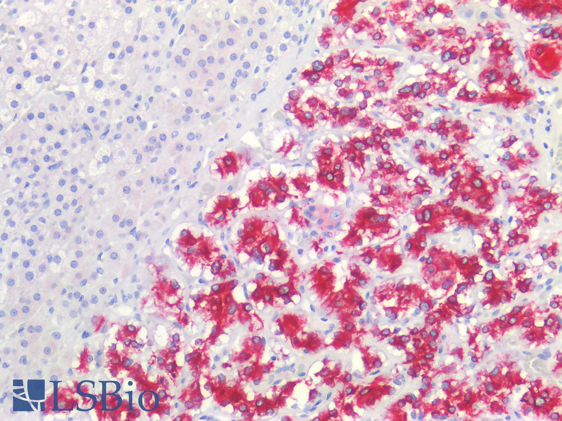 GRIN1 / NMDAR1 Antibody - Human Adrenal: Formalin-Fixed, Paraffin-Embedded (FFPE)