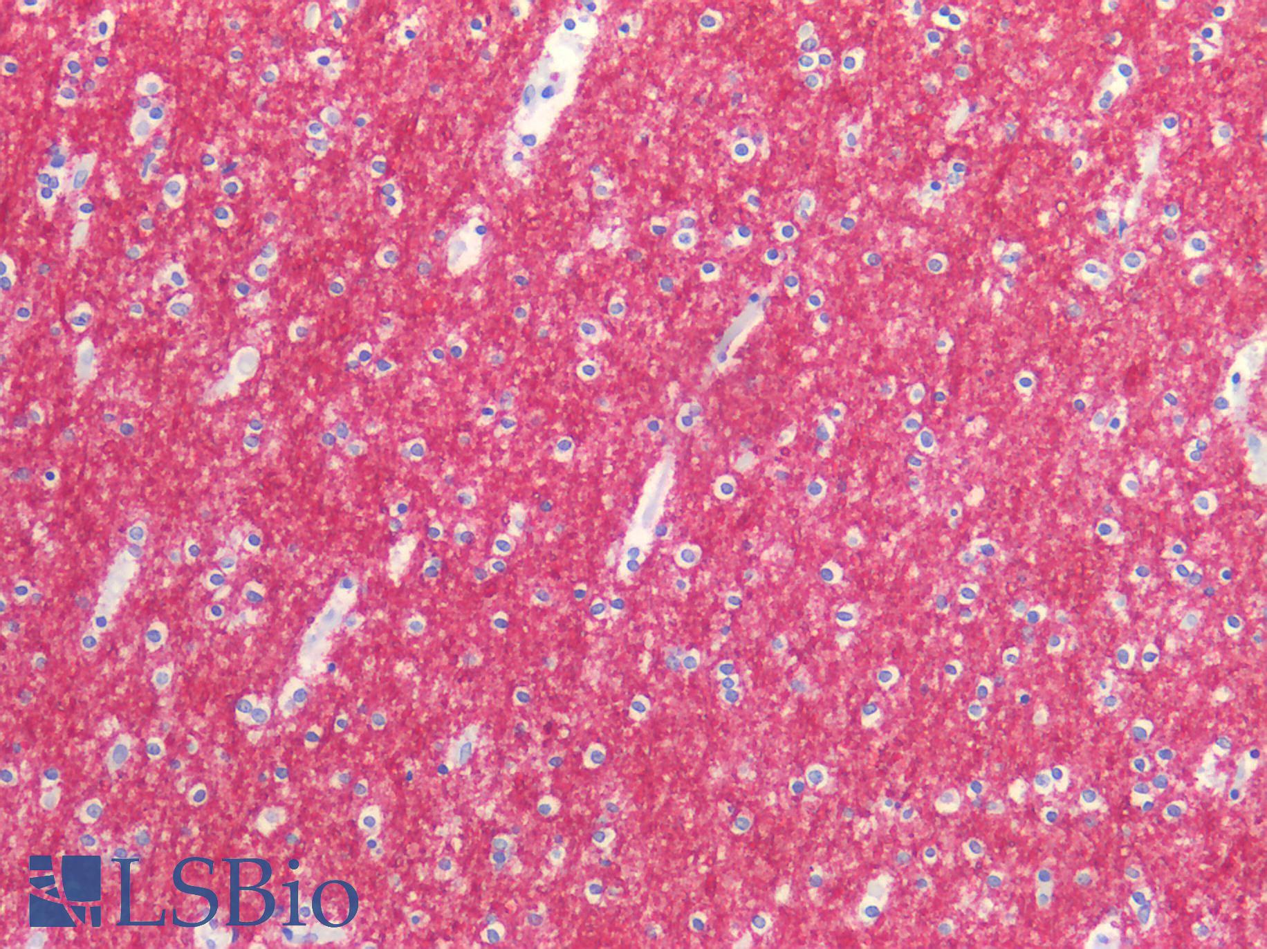 GRIN1 / NMDAR1 Antibody - Human Brain, Cortex: Formalin-Fixed, Paraffin-Embedded (FFPE)