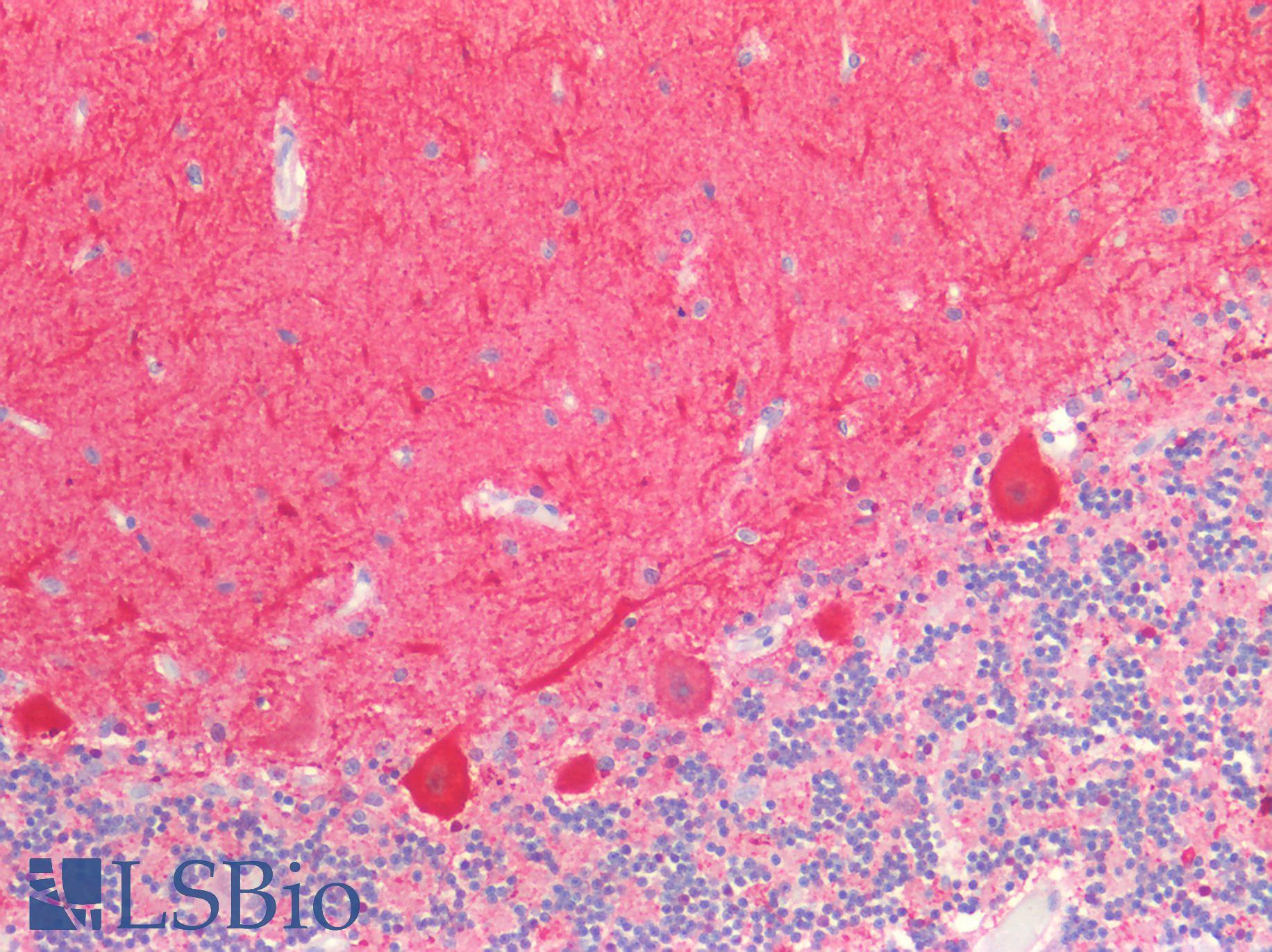 GRIN2A / NMDAR2A / NR2A Antibody - Human Brain, Cerebellum: Formalin-Fixed, Paraffin-Embedded (FFPE)