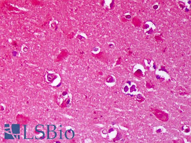 GRIN2B / NMDAR2B / NR2B Antibody - Anti-GRIN2B / NMDAR2B antibody IHC of human brain, cortex neurons. Immunohistochemistry of formalin-fixed, paraffin-embedded tissue after heat-induced antigen retrieval. Antibody concentration 5 ug/ml.  This image was taken for the unconjugated form of this product. Other forms have not been tested.
