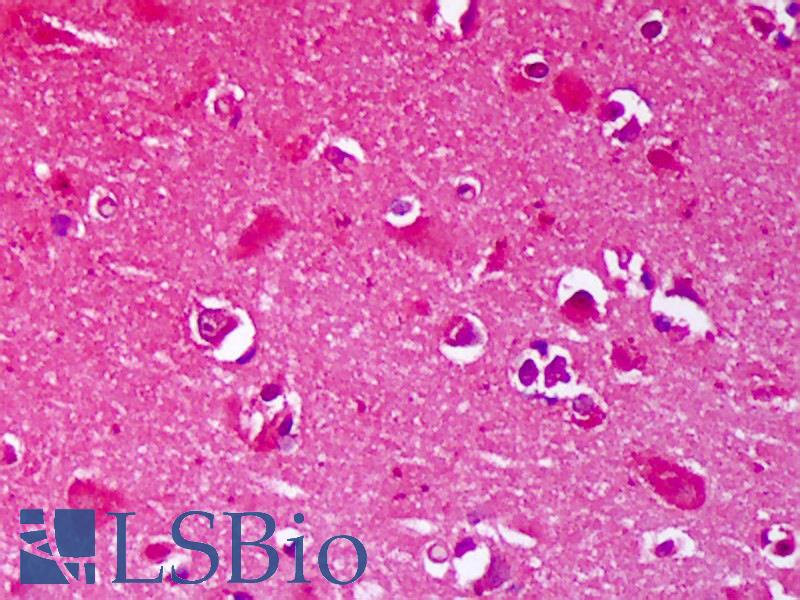 GRIN2B / NMDAR2B / NR2B Antibody - Anti-GRIN2B / NMDAR2B antibody IHC of human brain, cortex neurons. Immunohistochemistry of formalin-fixed, paraffin-embedded tissue after heat-induced antigen retrieval. Antibody concentration 5 ug/ml.  This image was taken for the unconjugated form of this product. Other forms have not been tested.