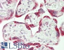 GRIP1 Antibody - Human Placenta: Formalin-Fixed, Paraffin-Embedded (FFPE)