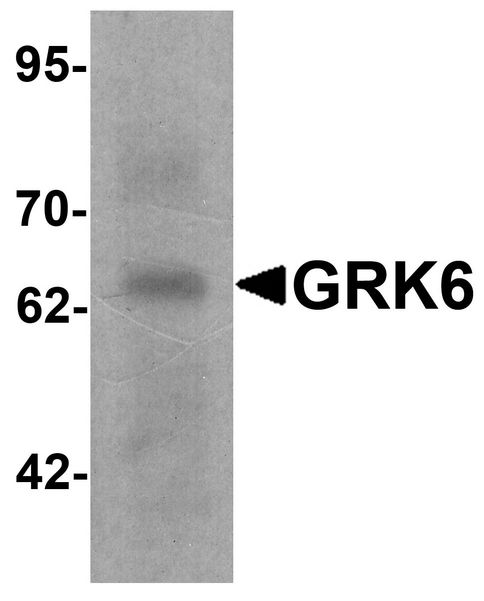 GRK6 Antibody - Western blot analysis of GRK6 in rat small intestine tissue lysate with GRK6 antibody at 1 ug/ml.
