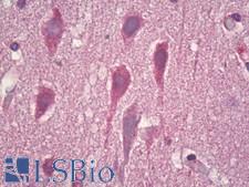 GRM8 / MGLUR8 Antibody - Anti-GRM8 / MGLUR8 antibody IHC of human brain, cortex neurons. Immunohistochemistry of formalin-fixed, paraffin-embedded tissue after heat-induced antigen retrieval. Antibody dilution 1:100.