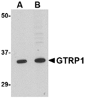 GRTP1 Antibody - Western blot of GRTP1 in K562 cell lysate with GRTP1 antibody at (A) 1 and (B) 2 ug/ml.