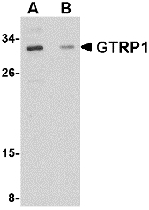 GRTP1 Antibody - Western blot of GRTP1 in SK-N-SH cell lysate with GRTP1 antibody at 1 ug/ml in the (A) absence and (B) presence of blocking peptide.