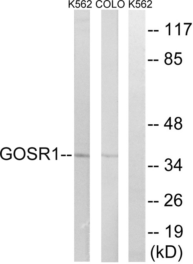 GS28 / GOSR1 / p28 Antibody - Western blot analysis of lysates from COLO and K562 cells, using GOSR1 Antibody. The lane on the right is blocked with the synthesized peptide.