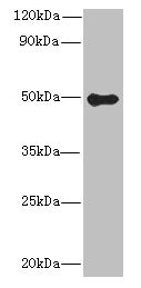 GSDMB / Gasdermin-Like Antibody - Western blot All lanes: GSDMB antibody at 8µg/ml + Colo320 whole cell lysate Secondary Goat polyclonal to rabbit IgG at 1/10000 dilution Predicted band size: 47, 46, 48, 19 kDa Observed band size: 47 kDa