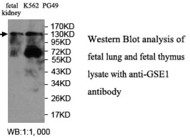 GSE1 / KIAA0182 Antibody