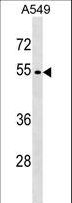 GSK3A / GSK3 Alpha Antibody - GSK3A Antibody western blot of A549 cell line lysates (35 ug/lane). The GSK3A antibody detected the GSK3A protein (arrow).