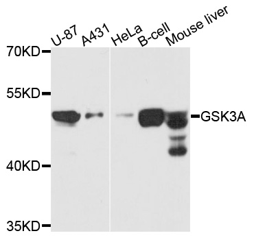 GSK3A / GSK3 Alpha Antibody - Western blot analysis of extracts of various cell lines, using GSK3A antibody at 1:1000 dilution. The secondary antibody used was an HRP Goat Anti-Rabbit IgG (H+L) at 1:10000 dilution. Lysates were loaded 25ug per lane and 3% nonfat dry milk in TBST was used for blocking. An ECL Kit was used for detection and the exposure time was 10s.