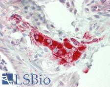 GSK3B / GSK3 Beta Antibody - Human Colon, Submucosal Plexus: Formalin-Fixed, Paraffin-Embedded (FFPE)