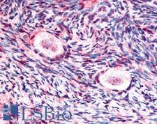 GSK3B / GSK3 Beta Antibody - Anti-GSK3B / GSK3 Beta antibody IHC of human ovary. Immunohistochemistry of formalin-fixed, paraffin-embedded tissue after heat-induced antigen retrieval. Antibody concentration 5 ug/ml.