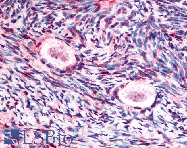 GSK3B / GSK3 Beta Antibody - Anti-GSK3B / GSK3 Beta antibody IHC of human ovary. Immunohistochemistry of formalin-fixed, paraffin-embedded tissue after heat-induced antigen retrieval. Antibody concentration 5 ug/ml.