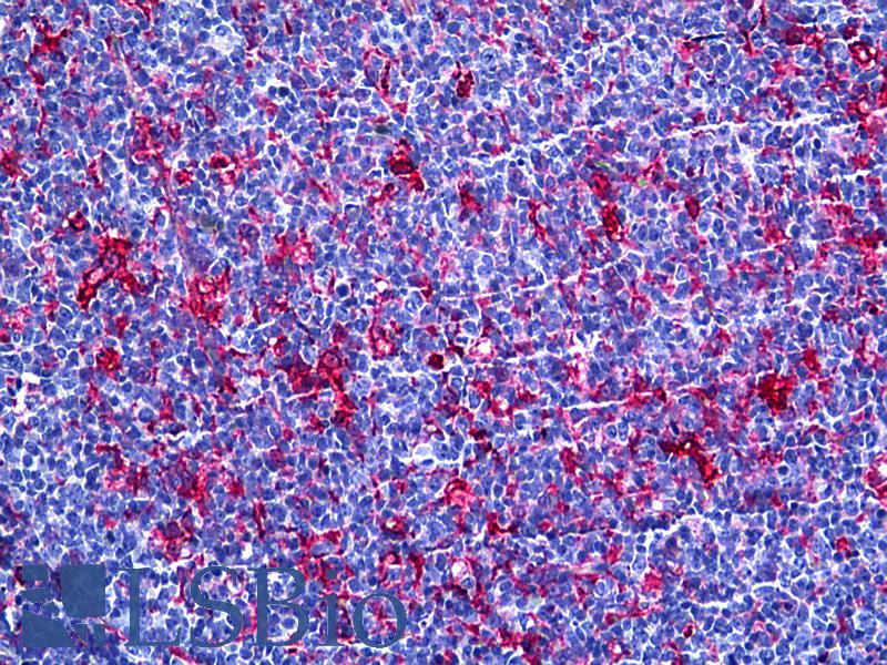 GSN / Gelsolin Antibody - Anti-Gelsolin antibody IHC of human tonsil. Immunohistochemistry of formalin-fixed, paraffin-embedded tissue after heat-induced antigen retrieval. Antibody concentration 5 ug/ml.