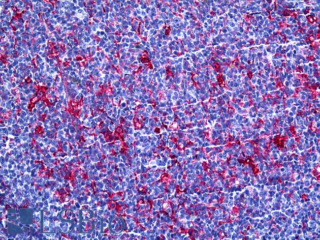 GSN / Gelsolin Antibody - Anti-Gelsolin antibody IHC of human tonsil. Immunohistochemistry of formalin-fixed, paraffin-embedded tissue after heat-induced antigen retrieval. Antibody concentration 5 ug/ml.