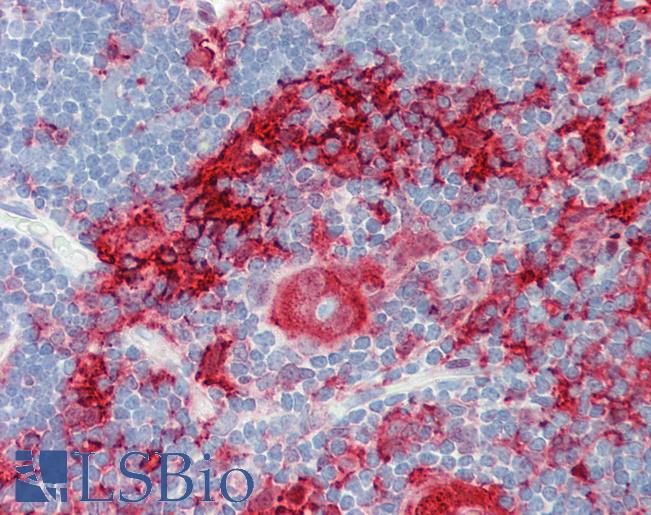 GSN / Gelsolin Antibody - Anti-GSN / Gelsolin antibody IHC staining of human thymus. Immunohistochemistry of formalin-fixed, paraffin-embedded tissue after heat-induced antigen retrieval.