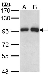 GSN / Gelsolin Antibody - Sample (30 ug of whole cell lysate). A: H1299. B: Hela. 7.5% SDS PAGE. GSN antibody diluted at 1:1000. 