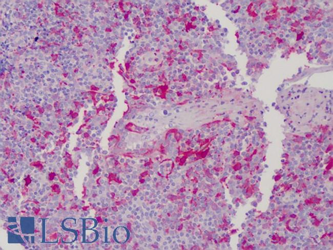 GSN / Gelsolin Antibody - Anti-Gelsolin antibody IHC of human tonsil. Immunohistochemistry of formalin-fixed, paraffin-embedded tissue after heat-induced antigen retrieval. Antibody concentration 10 ug/ml.