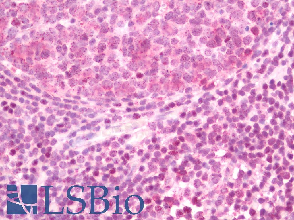 GSPT Antibody - Human Tonsil: Formalin-Fixed, Paraffin-Embedded (FFPE)