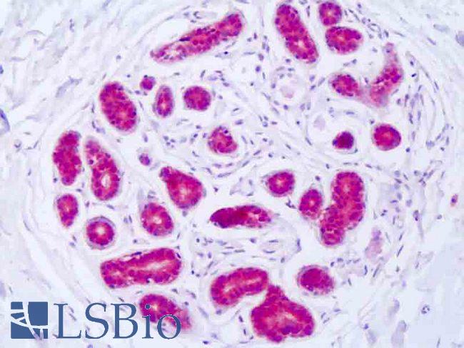 GSS / Glutathione Synthetase Antibody - Anti-GSS / Glutathione Synthetase antibody IHC of human breast epithelium. Immunohistochemistry of formalin-fixed, paraffin-embedded tissue after heat-induced antigen retrieval. Antibody dilution 1:50-1:100.