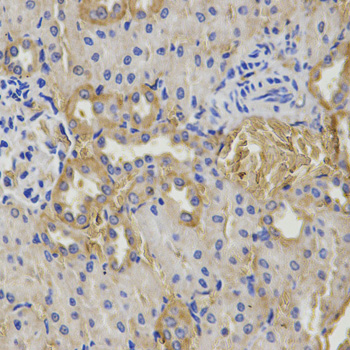 GSS / Glutathione Synthetase Antibody - Immunohistochemistry of paraffin-embedded rat kidney using GSS antibody at dilution of 1:200 (x400 lens)