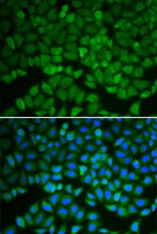 GSS / Glutathione Synthetase Antibody - Immunofluorescence analysis of A549 cells.