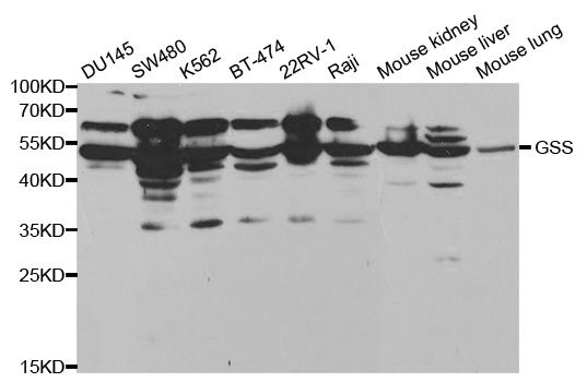 GSS / Glutathione Synthetase Antibody - Western blot analysis of extracts of various cell lines, using GSS antibody at 1:1000 dilution. The secondary antibody used was an HRP Goat Anti-Rabbit IgG (H+L) at 1:10000 dilution. Lysates were loaded 25ug per lane and 3% nonfat dry milk in TBST was used for blocking.