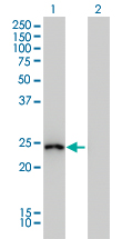 GSTA1 Antibody - Western blot of GSTA1 expression in transfected 293T cell line by GSTA1 monoclonal antibody.