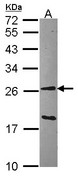 GSTA1 Antibody - Sample (30 ug of whole cell lysate). A: Hep G2 . 12% SDS PAGE. GSTA1 antibody. GSTA1 antibody diluted at 1:1000.