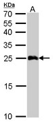 GSTA1 Antibody - GSTA1 antibody detects GSTA1 protein by Western blot analysis. A. 50 ug mouse liver lysate/extract. 12 % SDS-PAGE. GSTA1 antibody dilution:1:5000