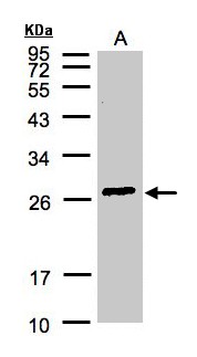 GSTA2 Antibody - Sample (30 ug of whole cell lysate). A: Hep G2. 12% SDS PAGE. GSTA2 antibody diluted at 1:3000