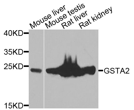 GSTA2 Antibody - Western blot blot of extracts of various cells, using GSTA2 antibody.