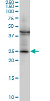 GSTM2 Antibody - Western blot of GSTM2 expression in NIH/3T3 cell lysate.