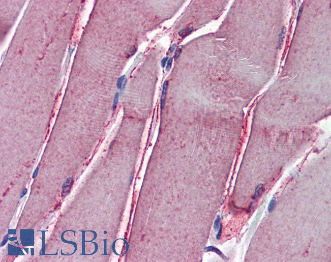 GSTM2 Antibody - Anti-GSTM2 antibody IHC of human skeletal muscle. Immunohistochemistry of formalin-fixed, paraffin-embedded tissue after heat-induced antigen retrieval. Antibody concentration 5 ug/ml.