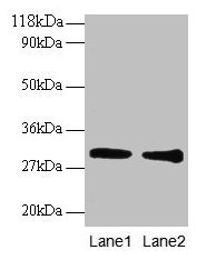 GSTP1 / GST Pi Antibody - Western blot All lanes: Glutathione S-transferase P antibody at 2µg/ml Lane 1: EC109 whole cell lysate Lane 2: 293T whole cell lysate Secondary Goat polyclonal to rabbit IgG at 1/15000 dilution Predicted band size: 23 kDa Observed band size: 30 kDa