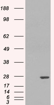 GSTP1 / GST Pi Antibody - HEK293 overexpressing GSTP1 (RC203086) and probed with (mock transfection in first lane).