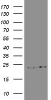 GSTP1 / GST Pi Antibody - HEK293T cells were transfected with the pCMV6-ENTRY control (Left lane) or pCMV6-ENTRY GSTP1 (Right lane) cDNA for 48 hrs and lysed. Equivalent amounts of cell lysates (5 ug per lane) were separated by SDS-PAGE and immunoblotted with anti-GSTP1.