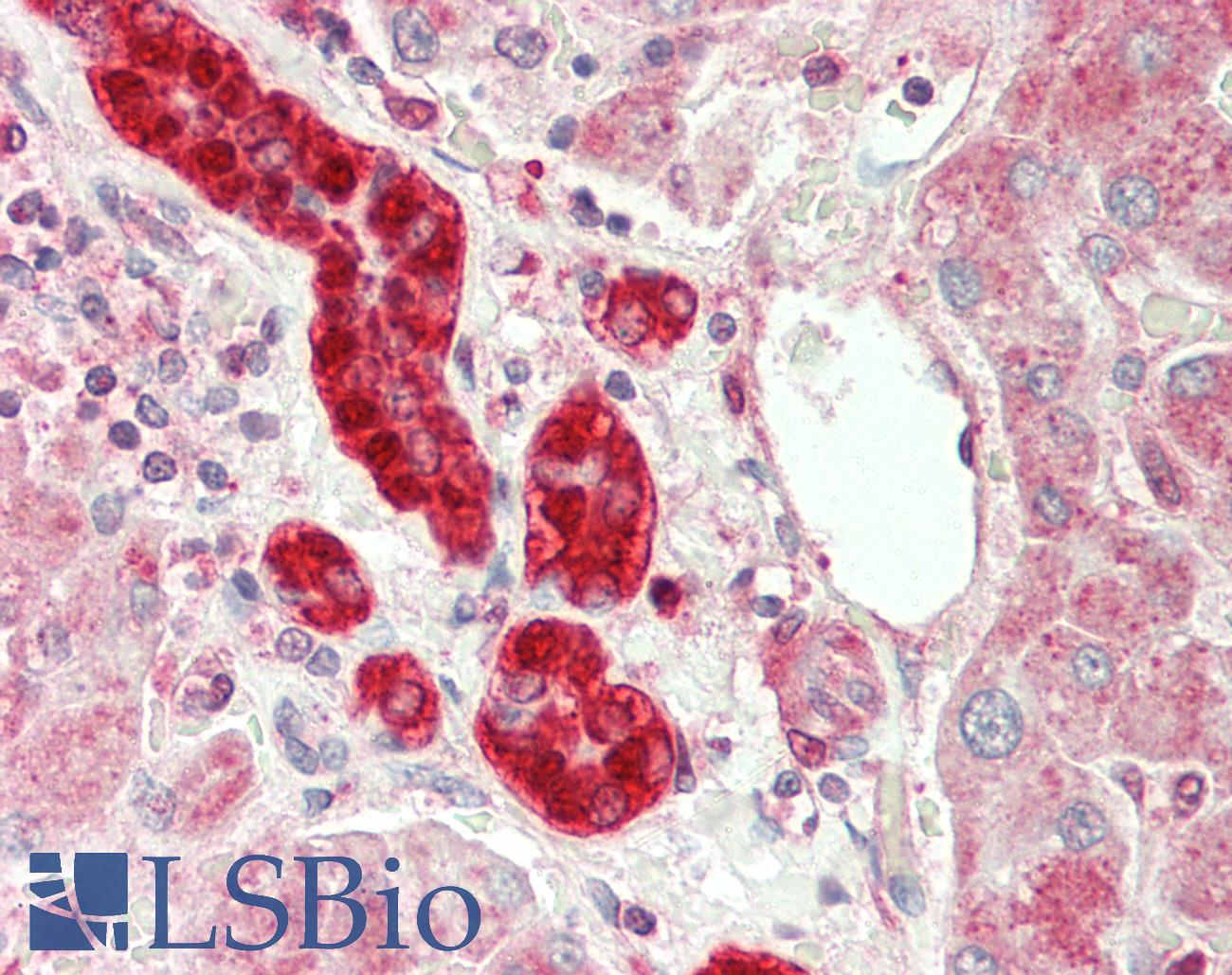 GSTP1 / GST Pi Antibody - Human Liver: Formalin-Fixed, Paraffin-Embedded (FFPE)
