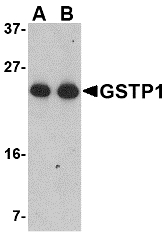 GSTP1 / GST Pi Antibody - Western blot of GSTP1 in Jurkat cell lysate with GSTP1 antibody at (A) 0.5 and (B) 1 ug/ml.