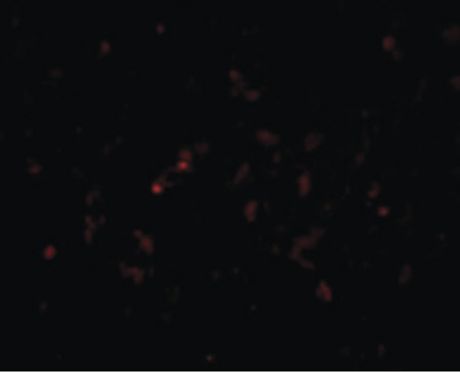 GSTP1 / GST Pi Antibody - Immunofluorescence of GSTP1 in Human Lung cells with GSTP1 antibody at 20 ug/ml.