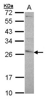 GSTP1 / GST Pi Antibody - Sample (30 ug of whole cell lysate). A: A431 . 12% SDS PAGE. GSTP1 / GST Pi antibody diluted at 1:5000.