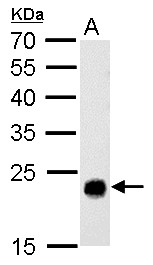 GSTT1 Antibody - GSTT1 antibody detects GSTT1 protein by Western blot analysis. A. 50 ug rat liver lysate/extract. 12 % SDS-PAGE. GSTT1 antibody dilution:1:500