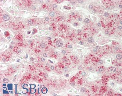 GSTT2 Antibody - Human Liver: Formalin-Fixed, Paraffin-Embedded (FFPE)