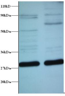 GT335 / ES1 Antibody - Western blot of ES1 protein homolog, mitochondrial antibody at 2 ug/ml. Lane 1: EC109 whole cell lysate. Lane 2: 293T whole cell lysate.  This image was taken for the unconjugated form of this product. Other forms have not been tested.