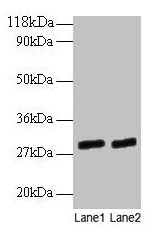 GT335 / ES1 Antibody - Western blot All lanes: ES1 protein homolog, mitochondrial antibody at 2µg/ml Lane 1: EC109 whole cell lysate Lane 2: 293T whole cell lysate Secondary Goat polyclonal to rabbit IgG at 1/15000 dilution Predicted band size: 29, 25 kDa Observed band size: 29 kDa