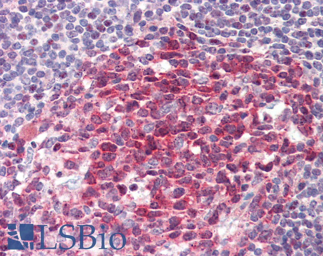 GTF2A1 / TFIIA Antibody - Anti-GTF2A1 / TFIIA antibody IHC staining of human tonsil. Immunohistochemistry of formalin-fixed, paraffin-embedded tissue after heat-induced antigen retrieval. Antibody dilution 1:100.