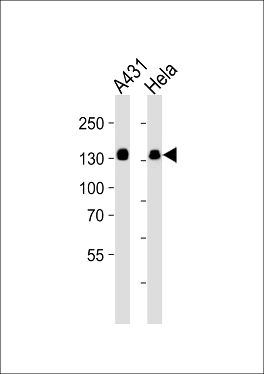 GTF2I / TFII I Antibody - Western blot of lysates from A431, HeLa cell line (from left to right), using GTF2I Antibody. Antibody was diluted at 1:1000 at each lane. A goat anti-rabbit IgG H&L (HRP) at 1:5000 dilution was used as the secondary antibody. Lysates at 35ug per lane.
