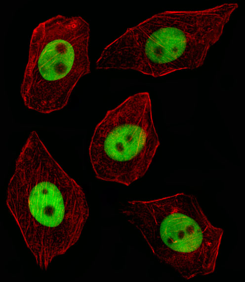 GTF2I / TFII I Antibody - Fluorescent image of A549 cell stained with GTF2I Antibody. A549 cells were fixed with 4% PFA (20 min), permeabilized with Triton X-100 (0.1%, 10 min), then incubated with GTF2I primary antibody (1:25, 1 h at 37°C). For secondary antibody, Alexa Fluor 488 conjugated donkey anti-rabbit antibody (green) was used (1:400, 50 min at 37°C). Cytoplasmic actin was counterstained with Alexa Fluor 555 (red) conjugated Phalloidin (7units/ml, 1 h at 37°C). GTF2I immunoreactivity is localized to Nucleus significantly.